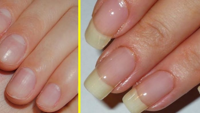 Astuces Maison Asiatiques Pour Faire Pousser Vos Ongles Plus