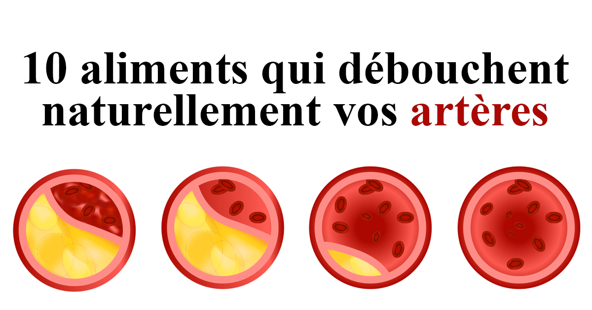 Aliments Qui D Bouchent Naturellement Vos Art Res Rire Et Art